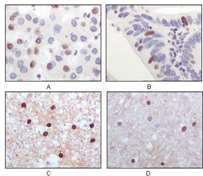 KAT5 / TIP60 Antibody (clone 3F9)