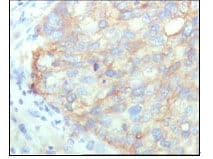 KARS Antibody (Amino Acid: 90-174, clone 8G12C1)