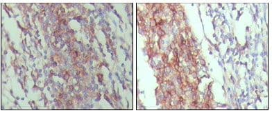 Monoclonal Mouse anti-Human CD45 / LCA Antibody (clone 4A8A4C7A2, IHC, WB)