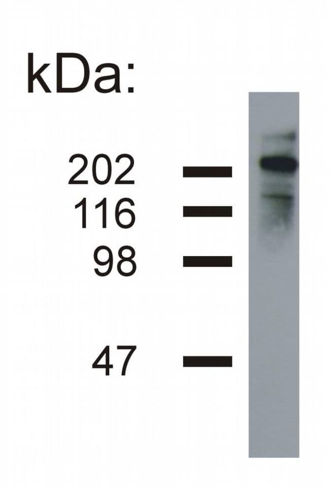Monoclonal Mouse anti-Human NEFH / NF-H Antibody (clone NF-05, IHC, WB)