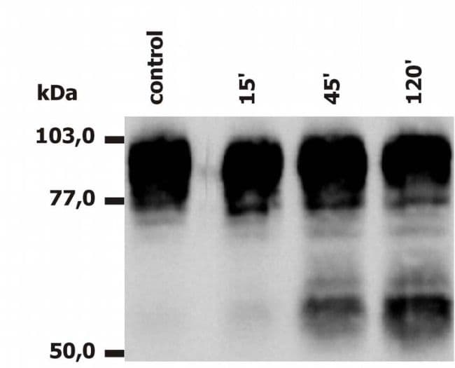ITGB2 / CD18 Antibody (clone MEM-148)
