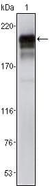 PDGFRB / PDGFR Beta Antibody (clone 1A2)