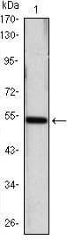 SHH / Sonic Hedgehog Antibody (clone 8G3)