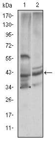 Monoclonal Mouse anti-Human CST3 / Cystatin C Antibody (clone 5H2, WB)