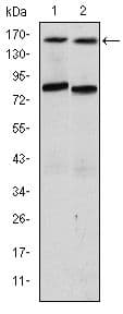 Monoclonal Mouse anti-Human NCOA3 / SRC-3 / AIB1 Antibody (clone 5H3, WB)