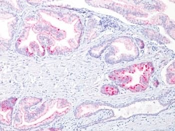 AMACR / P504S Antibody (clone 13H4)