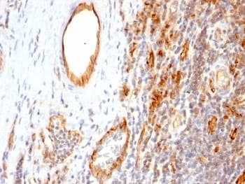 PECAM-1 / CD31 Antibody (clone 1A10)