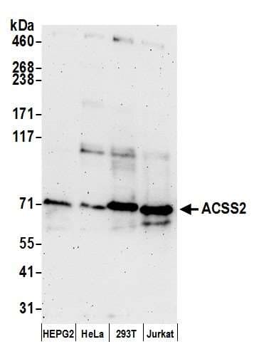 Polyclonal Rabbit anti-Human ACSS2 / ACAS2 Antibody (aa450-500, WB)