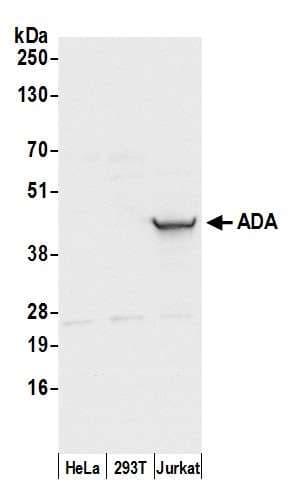 ADA / Adenosine Deaminase Antibody (aa100-150)