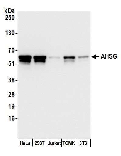 AHSG / Fetuin A Antibody (aa25-75)