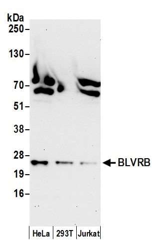 Polyclonal Rabbit anti-Human GHBP / BLVRB Antibody (aa25-75, WB)