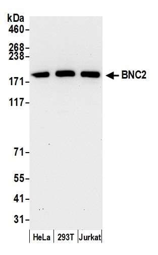 BNC2 Antibody (aa350-400)