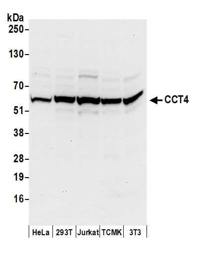 Polyclonal Rabbit anti-Human CCT4 / SRB Antibody (aa489-539, WB)
