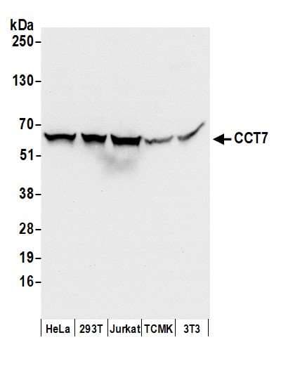 Polyclonal Rabbit anti-Human CCT7 Antibody (aa493-543, WB)