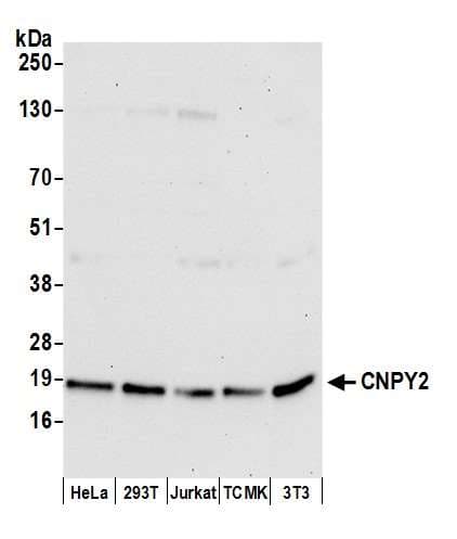 Polyclonal Rabbit anti-Human Cnpy2 / TMEM4 Antibody (aa100-150, WB)