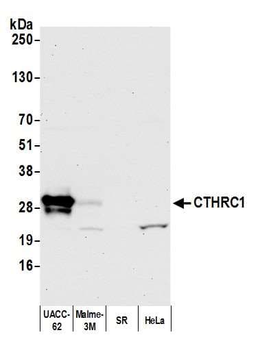 Polyclonal Rabbit anti-Human CTHRC1 Antibody (aa25-75, WB)