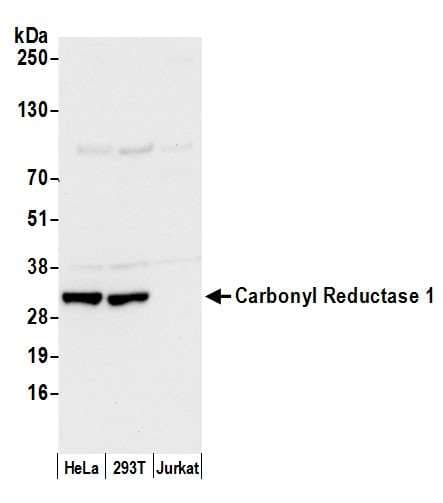 Polyclonal Rabbit anti-Human CBR / CBR1 Antibody (aa227-277, WB)