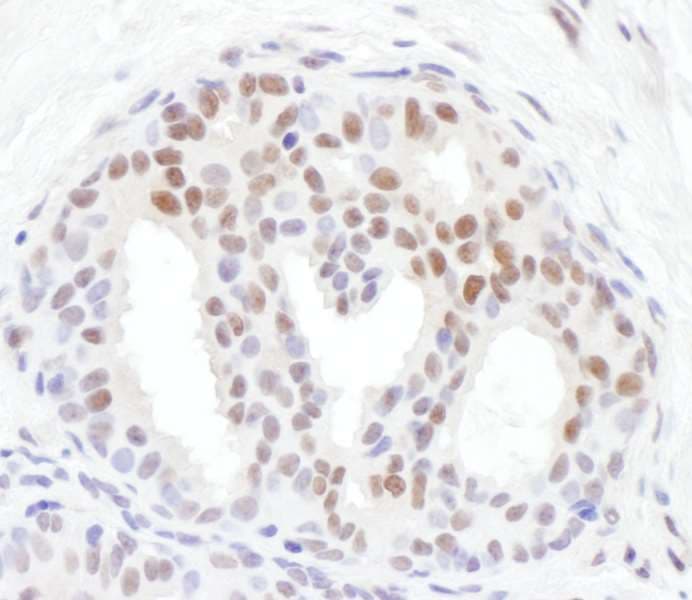 Polyclonal Rabbit anti-Human CHEK1 / CHK1 Antibody (phospho-Ser371, IHC, WB)