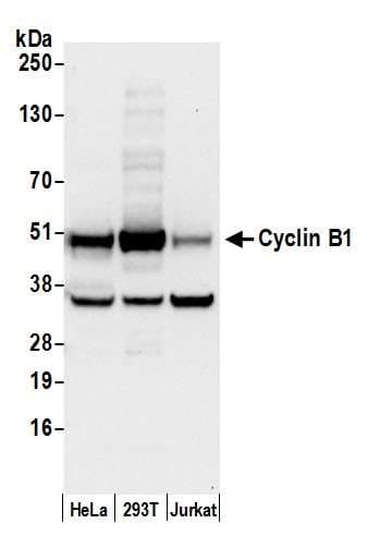 Polyclonal Rabbit anti-Human CCNB1 / Cyclin B1 Antibody (aa1-50, WB)