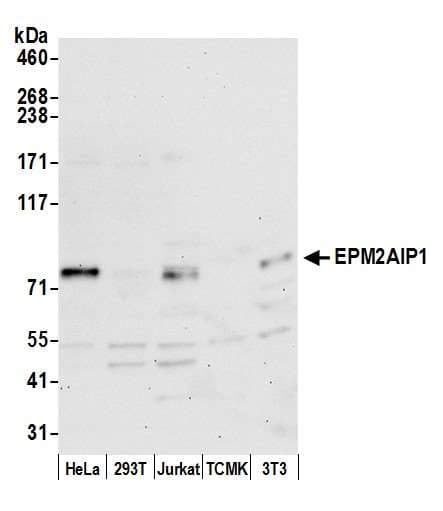 Polyclonal Rabbit anti-Human EPM2AIP1 Antibody (aa100-150, WB)