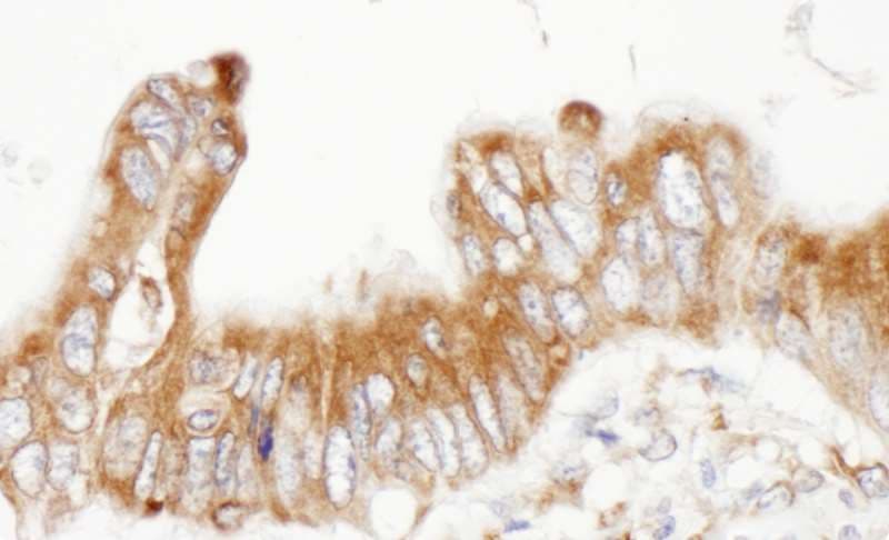 Polyclonal Rabbit anti-Human PDIA6 / ERP5 Antibody (aa390-440, IHC, WB)