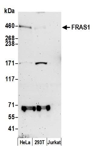 FRAS1 Antibody (aa3025-3075)