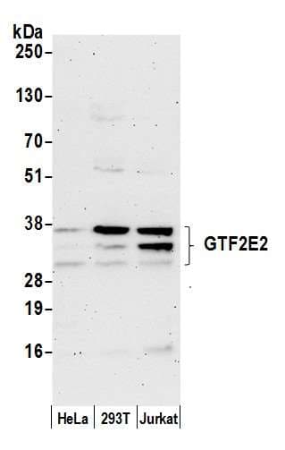 Polyclonal Rabbit anti-Human GTF2E2 Antibody (aa241-291, WB)