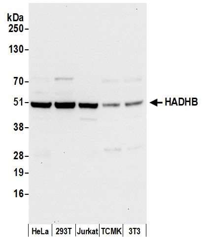 Polyclonal Rabbit anti-Human HADHB Antibody (aa225-275, WB)