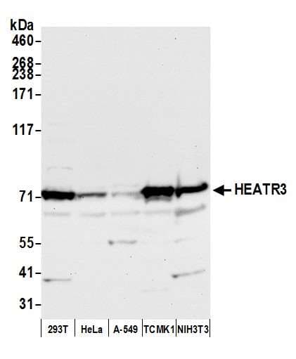 Polyclonal Rabbit anti-Human HEATR3 Antibody (aa25-75, WB)