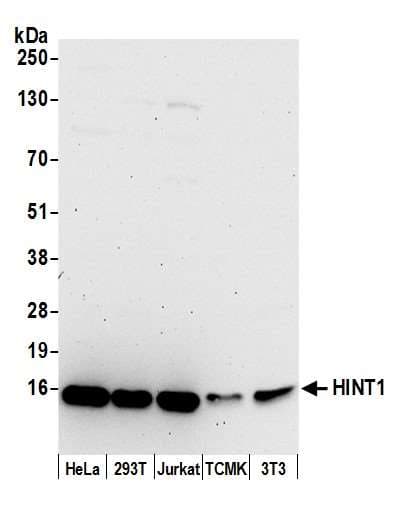 Polyclonal Rabbit anti-Human HINT / HINT1 Antibody (aa76-126, WB)