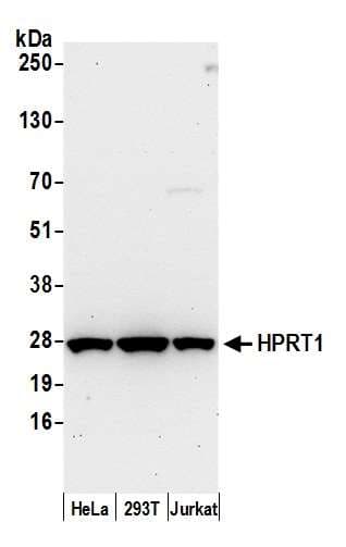 Polyclonal Rabbit anti-Human HPRT1 / HPRT Antibody (aa1-50, WB)