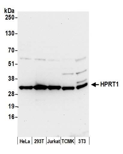 Polyclonal Rabbit anti-Human HPRT1 / HPRT Antibody (aa168-218, WB)