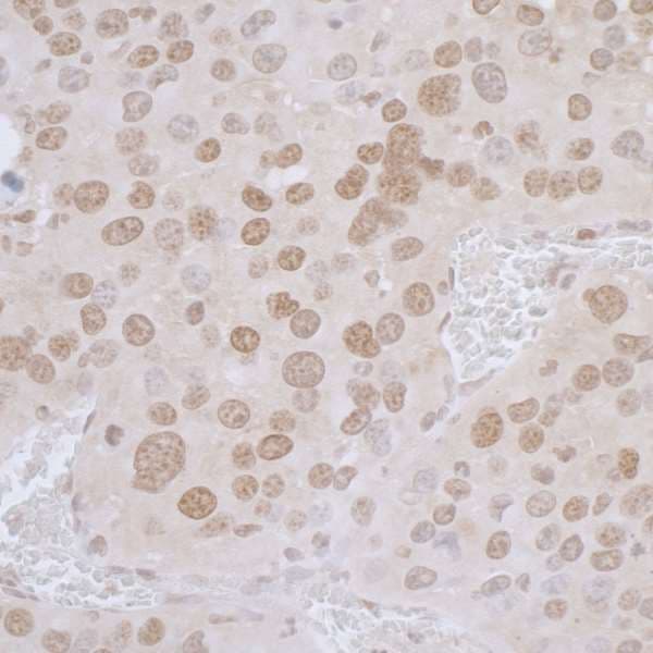 Polyclonal Rabbit anti-Human TMPO / TP / Thymopoietin Antibody (aa200-250, IHC, WB)