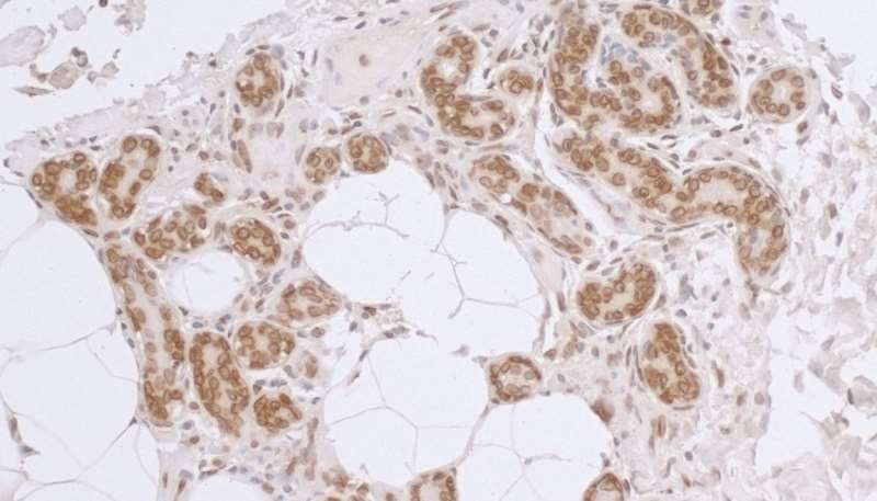 Polyclonal Rabbit anti-Human TMPO / TP / Thymopoietin Antibody (aa404-454, IHC, WB)