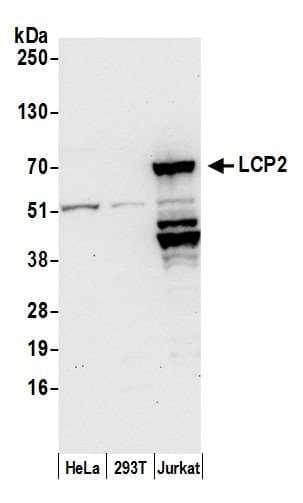 Polyclonal Rabbit anti-Human LCP2 / SLP-76 Antibody (aa225-275, WB)