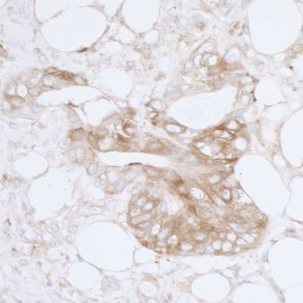Polyclonal Rabbit anti-Human MVP / VAULT1 Antibody (aa1-50, IHC, WB)