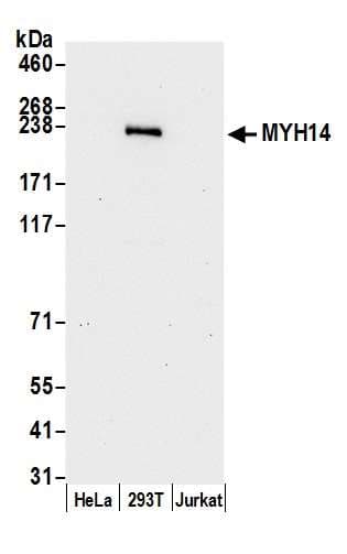 MYH14 Antibody (aa1945-1995)