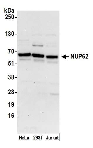 Polyclonal Rabbit anti-Human NUP62 Antibody (aa472-522, WB)