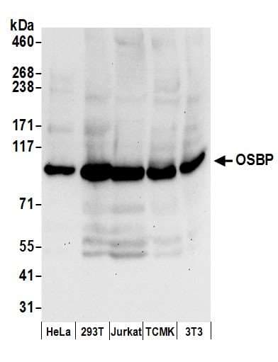 Polyclonal Rabbit anti-Human OSBP Antibody (aa740-790, WB)