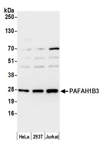 Polyclonal Rabbit anti-Human PAFAH1B3 Antibody (aa1-50, WB)