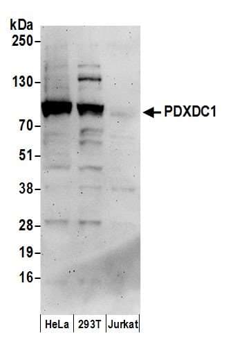 Polyclonal Rabbit anti-Human PDXDC1 Antibody (aa725-775, WB)