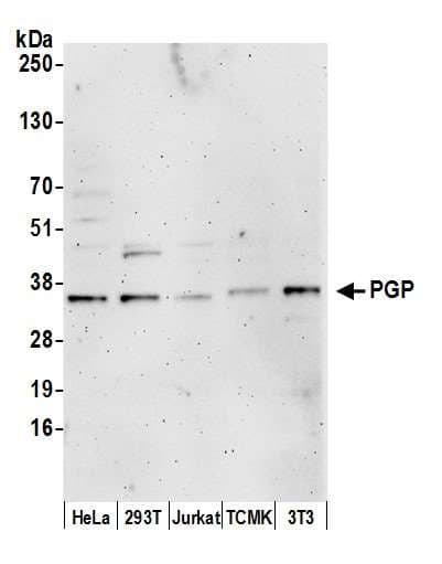 Polyclonal Rabbit anti-Human PGP Antibody (aa271-321, WB)