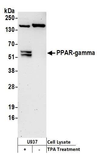 Polyclonal Rabbit anti-Human PPARG / PPAR Gamma Antibody (aa50-100, WB)