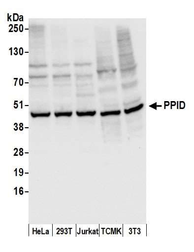 Polyclonal Rabbit anti-Human PPID / Cyclophilin D Antibody (aa175-225, WB)