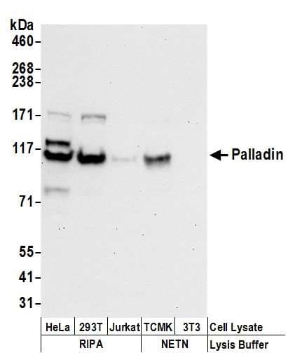 Polyclonal Rabbit anti-Human PALLD / Palladin Antibody (aa75-125, WB)