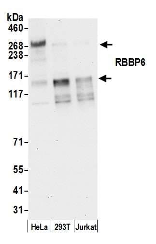 Polyclonal Rabbit anti-Human RBBP6 Antibody (aa50-100, WB)