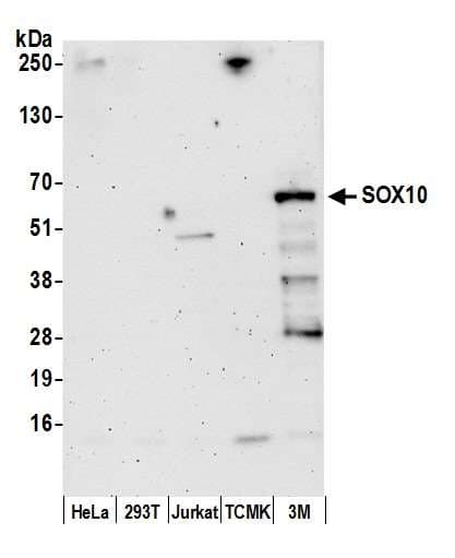 Polyclonal Rabbit anti-Human SOX10 Antibody (aa1-50, WB)