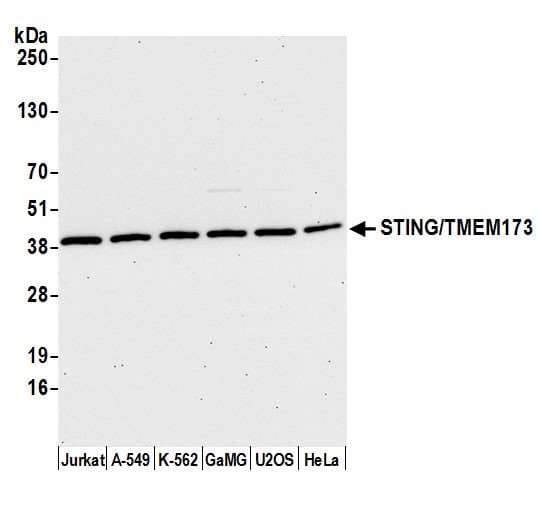 TMEM173 / STING Antibody (aa329-379)