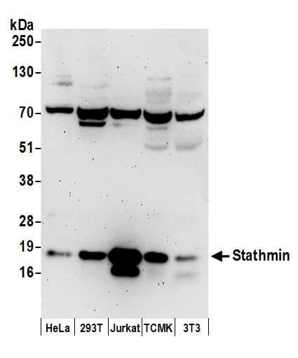 STMN1 / Stathmin / LAG Antibody (aa99-149)
