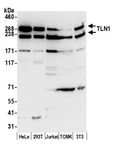 Polyclonal Rabbit anti-Human TLN1 / Talin 1 Antibody (aa2491-2541, WB)